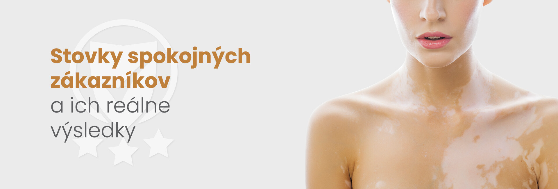 vitiligo vysledky