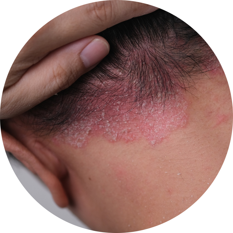 Starostlivosť o pokožku