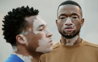 Vitiligo v móde: Krása v rôznorodosti | Vitiligoshop.sk