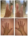 Vitiligo Štartovací Set (200ml Gel + 60 Tabliet + Zanderm korektor)