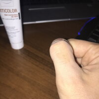 Vitiligo - kozmetická kamufláž Vitiligo - kozmetická kamufláž
